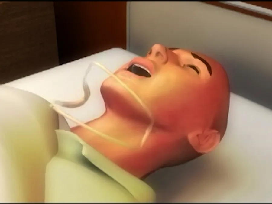 Szene aus dem Anwendungsfilm, Schritt 2: der kleinere Bügel der Kinnstütze wird unter dem Kinn positioniert (Animation)