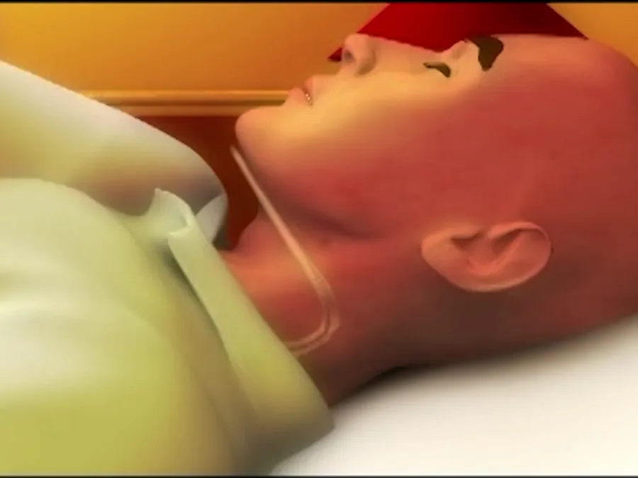 Szene aus dem Anwendungsfilm, Schritt 4: die Kleidung liegt über der Kinnstütze, sie bleibt nahezu unsichtbar (Animation)